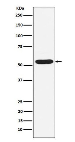 PIAS2 Antibody (SR1996), Novus Biologicals:Antibodies:Primary Antibodies