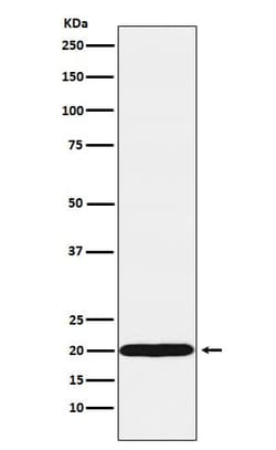 UbcH10/UBE2C Antibody (SR1319), Novus Biologicals:Antibodies:Primary Antibodies
