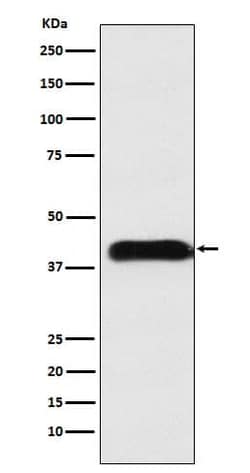 CD-M6PR Antibody (SR1712), Novus Biologicals:Antibodies:Primary Antibodies
