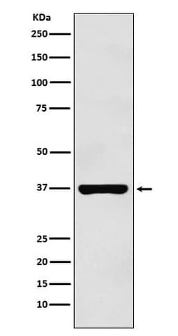 PIM2 Antibody (SR1624), Novus Biologicals 50 &mu;g; Unconjugated:Antibodies,