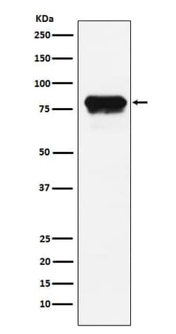 PLTP Antibody (SR2240), Novus Biologicals:Antibodies:Primary Antibodies