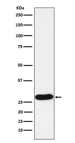 Proteinase 3/Myeloblastin/PRTN3 Antibody (SR1444), Novus Biologicals 50