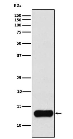 Cystatin A Antibody (SR1147), Novus Biologicals 100 &mu;g; Unconjugated:Antibodies,