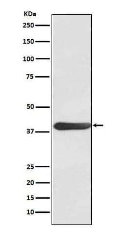 FRA-1/FOSL1 Antibody (SR1652), Novus Biologicals:Antibodies:Primary Antibodies