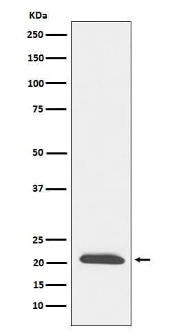 DCTN3 Antibody (SR1324), Novus Biologicals:Antibodies:Primary Antibodies