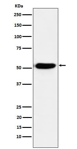 IRF4 Antibody (SR1923), Novus Biologicals:Antibodies:Primary Antibodies