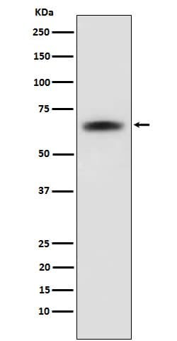 SENP2 Antibody (SR2130), Novus Biologicals 50 &mu;g; Unconjugated:Antibodies,