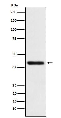 Tropomodulin 2 Antibody (SR1682), Novus Biologicals 50 &mu;g; Unconjugated:Antibodies,