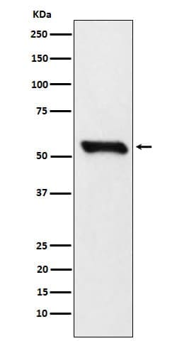 Dihydrolipoamide Dehydrogenase/DLD Antibody (SR2009), Novus Biologicals:Antibodies:Primary