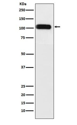 SERCA1 ATPase Antibody (SR1065), Novus Biologicals 50 &mu;g; Unconjugated:Antibodies,