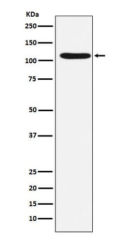 HIRA Antibody (SR1066), Novus Biologicals:Antibodies:Primary Antibodies
