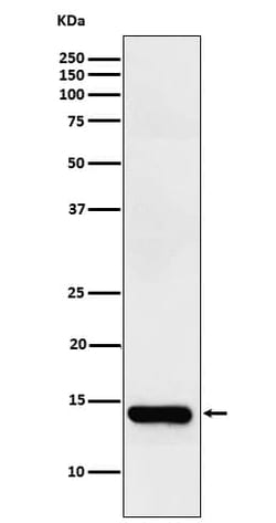 FABP2/I-FABP Antibody (SR1211), Novus Biologicals 100 &mu;g; Unconjugated:Anticorps,