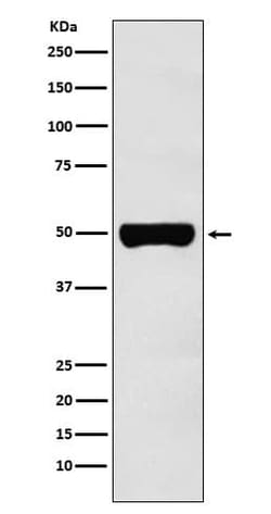 CHX10 Antibody (SR1872), Novus Biologicals 100 &mu;g; Unconjugated:Antibodies,