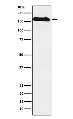 NAIP Antibody (SR1227), Novus Biologicals 50 &mu;g; Unconjugated:Antibodies,