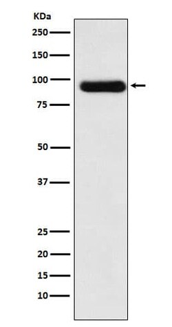 Activin RIIA Antibody (SR2253), Novus Biologicals:Antibodies:Primary Antibodies