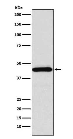 Somatostatin R5/SSTR5 Antibody (SR1723), Novus Biologicals 100 &mu;g; Unconjugated:Antibodies,