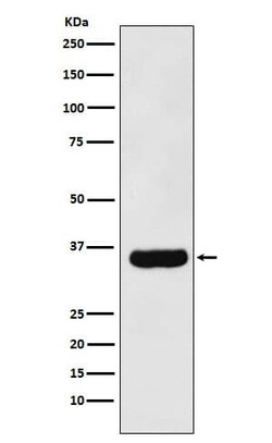 MFF Antibody (SR1564), Novus Biologicals 100 &mu;g; Unconjugated:Antibodies,