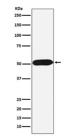 FKBP38 Antibody (SR1916), Novus Biologicals 100 &mu;g; Unconjugated:Antibodies,