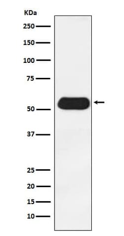 ERR gamma/NR3B3 Antibody (SR1899), Novus Biologicals 100 &mu;g; Unconjugated:Antibodies,