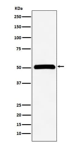 CUGBP1/CELF1 Antibody (SR1914), Novus Biologicals:Antibodies:Primary Antibodies