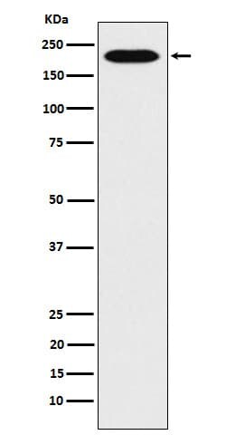 RhoGAP Antibody (SR1304), Novus Biologicals:Antibodies:Primary Antibodies