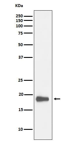 HMGN2 Antibody (SR1289), Novus Biologicals 100 &mu;g; Unconjugated:Antibodies,