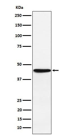 HLA F Antibody (SR1707), Novus Biologicals 50 &mu;g; Unconjugated:Antibodies,