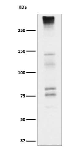 Neurocan Antibody (SR1121), Novus Biologicals:Antibodies:Primary Antibodies