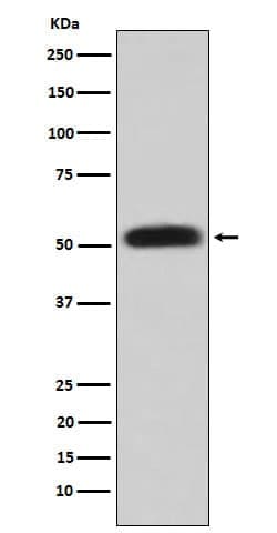 Glycerol Kinase Antibody (SR1882), Novus Biologicals 100 &mu;g; Unconjugated:Antibodies,