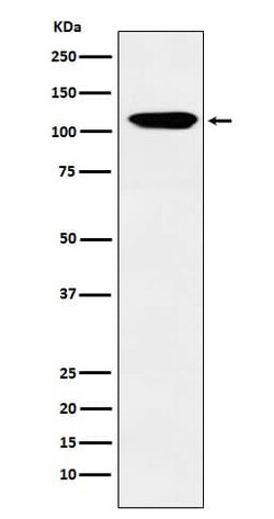 EphB3 Antibody (SR1056), Novus Biologicals 100 &mu;g; Unconjugated:Antibodies,