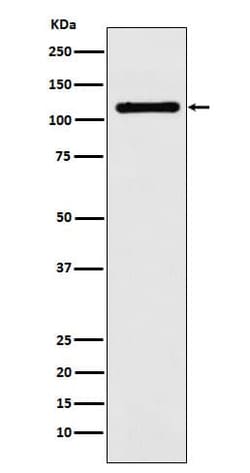DPYD Antibody (SR1055), Novus Biologicals 50 &mu;g; Unconjugated:Antibodies,