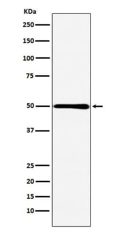 HMGCS2 Antibody (SR1885), Novus Biologicals 100 &mu;g; Unconjugated:Antibodies,