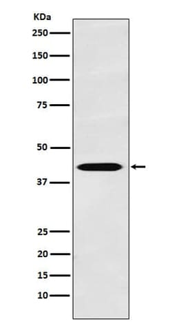TROY/TNFRSF19 Antibody (SR1804), Novus Biologicals 50 &mu;g; Unconjugated:Antibodies,
