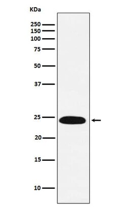 VPS28 Antibody (SR1407), Novus Biologicals 50 &mu;g; Unconjugated:Antibodies,