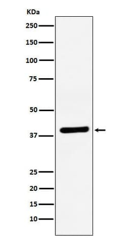 VEGF-D Antibody (SR1683), Novus Biologicals:Antibodies:Primary Antibodies