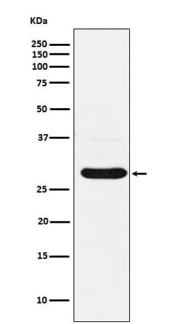 CHMP2B Antibody (SR1463), Novus Biologicals:Antibodies:Primary Antibodies