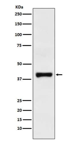 GOT2 Antibody (SR1734), Novus Biologicals:Antibodies:Primary Antibodies