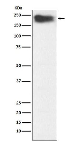 MYH7B Antibody (SR1337), Novus Biologicals:Antibodies:Primary Antibodies