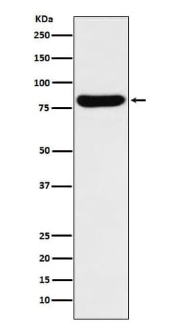 beta-Glucuronidase/GUSB Antibody (SR2217), Novus Biologicals:Antibodies:Primary