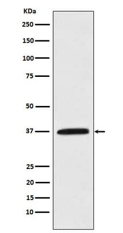 Kallikrein 5 Antibody (SR1617), Novus Biologicals 100 &mu;g; Unconjugated:Antibodies,