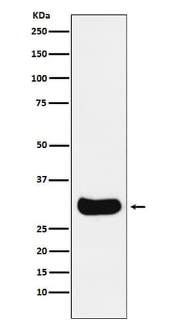 GEMIN2 Antibody (SR1523), Novus Biologicals:Antibodies:Primary Antibodies