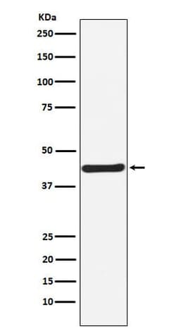 HOXA5 Antibody (SR1735), Novus Biologicals:Antibodies:Primary Antibodies