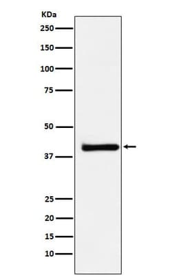 XRCC3 Antibody (SR1724), Novus Biologicals 100 &mu;g; Unconjugated:Anticuerpos