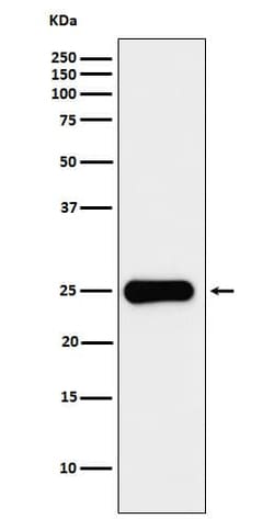 Placental Lactogen/CSH1 Antibody (SR1402), Novus Biologicals 50 &mu;g;