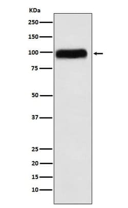 Serpin G1/C1 Inhibitor Antibody (SR1022), Novus Biologicals:Antibodies:Primary