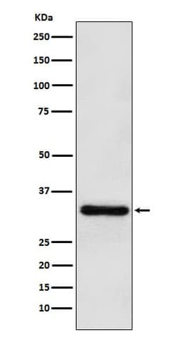PITX3 Antibody (SR1536), Novus Biologicals 50 &mu;g; Unconjugated:Antibodies,