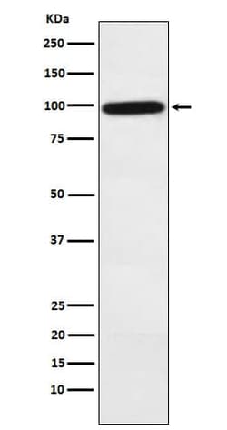 Complement Factor B Antibody (SR1011), Novus Biologicals 50 &mu;g; Unconjugated:Antibodies,