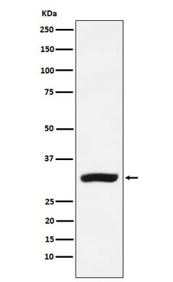 CBR1 Antibody (SR1506), Novus Biologicals 100 &mu;g; Unconjugated:Antibodies,