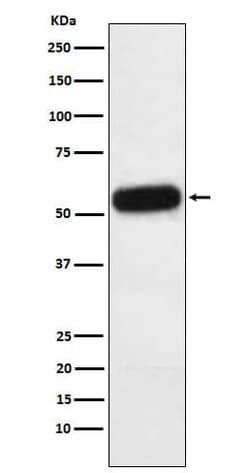 Fetuin A/AHSG Antibody (SR2026), Novus Biologicals 100 &mu;g; Unconjugated:Antibodies,