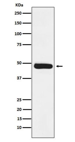 ERCC8 Antibody (SR1749), Novus Biologicals 50 &mu;g | Buy Online | Novus Biologicals | Fisher Scientific